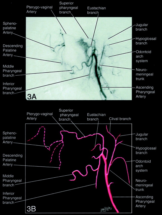 Fig 3.