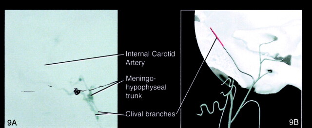 Fig 9.