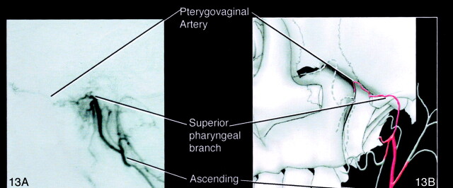 Fig 13.