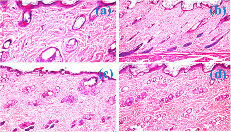 Fig. 15