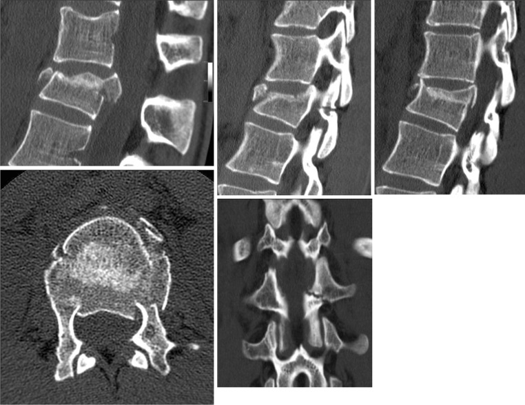 Fig. 10