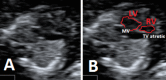 A,B