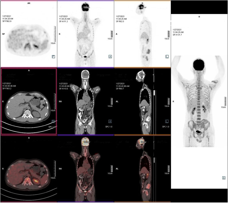 Figure 4