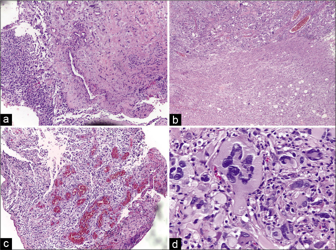 Figure 2: