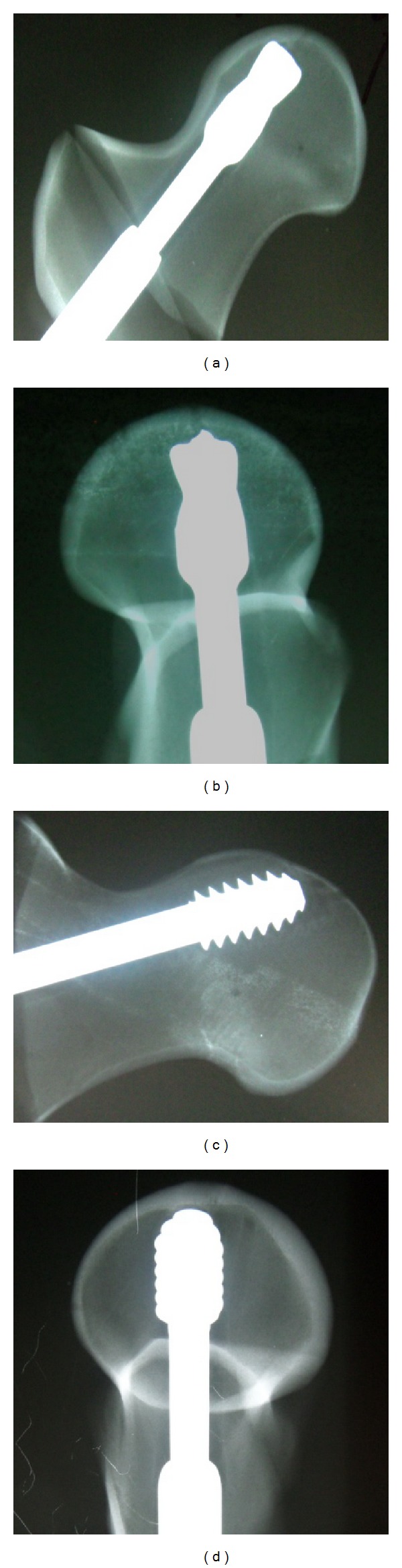 Figure 4