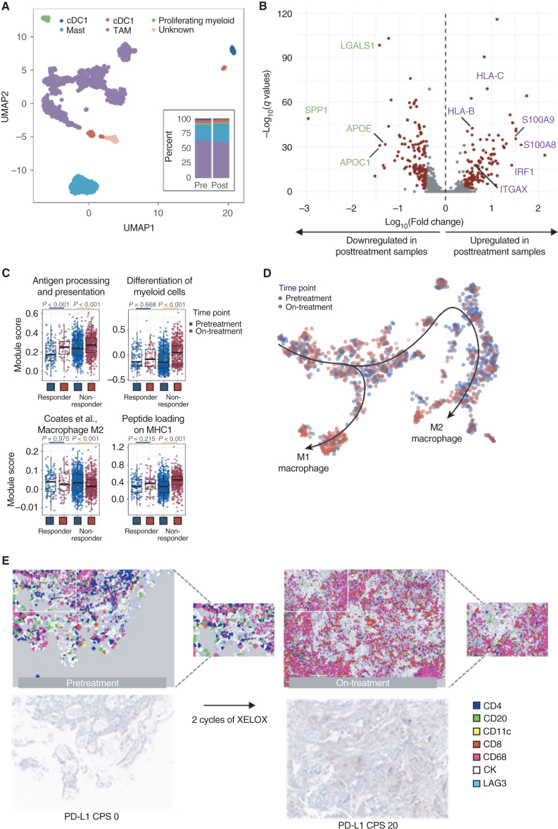 Figure 3. Transcriptional reprogramming of TAMs during first-line chemotherapy. A, UMAP embedding 1,902 myeloid cell population of scRNA-seq data. Multiple clusters represent various subtypes of myeloid cells in the TME of AGC. Bar plots demonstrating relative proportions of myeloid subtypes in pretreatment and posttreatment AGC samples (plot A inset). B, A volcano plot showing differentially expressed genes in scRNA-seq data between pretreatment and on-treatment samples. Genes marked in green and purple are related to M2 and M1 macrophage states, respectively. C, Differentially enriched pathways in macrophages between pretreatment and on-treatment samples from responder and nonresponder patients with AGC. Module scores were estimated using an algorithm embedded in Seurat package. Box plots describe the median and interquartile range of the expression. Significance of differences was estimated by the Wilcoxon signed-rank test. D, Pseudotime trajectories of macrophages demonstrating different developmental trajectory in pretreatment and on-treatment samples. We used the Slingshot algorithm to reconstruct the trajectories. Each dot represents a macrophage in pretreatment (blue) and posttreatment (red) samples. E, mIF images characterizing the TME of AGC before and during first-line chemotherapy in a representative case (EP-02) who showed PD-L1 upregulation and response to chemotherapy.