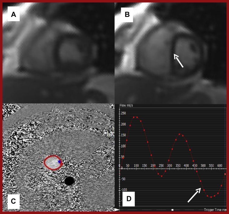 Figure 11