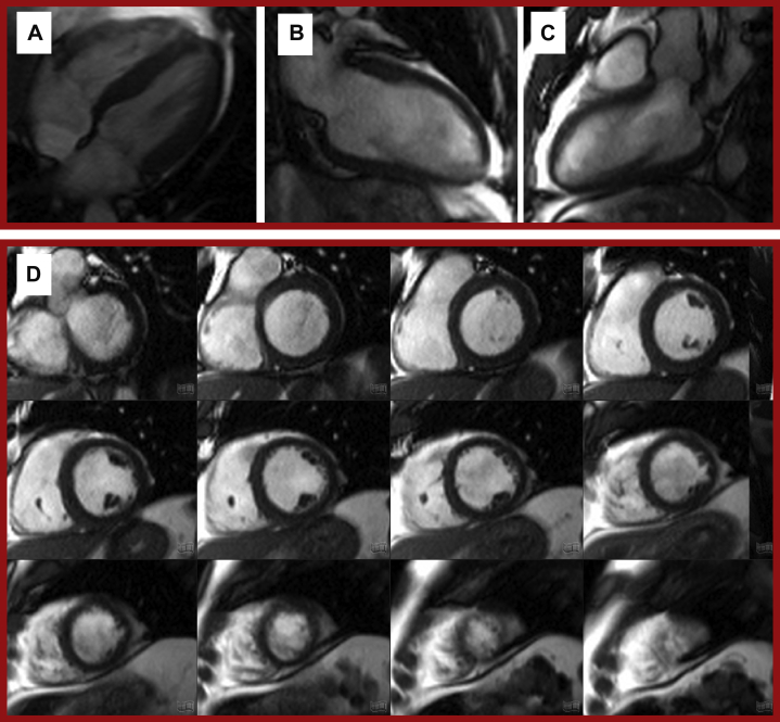 Figure 4