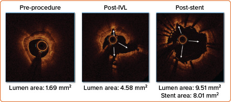 Figure 3: