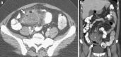 Fig. 3a, b