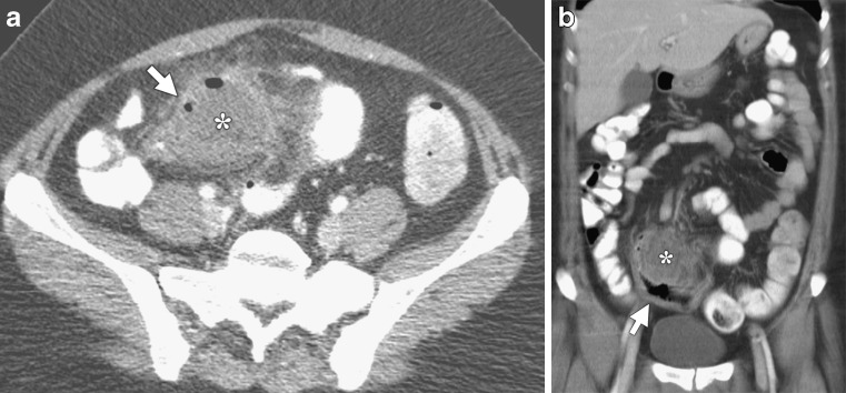 Fig. 3a, b