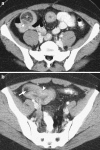 Fig. 10a, b