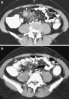 Fig. 6a, b
