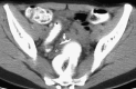 Fig. 11