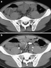 Fig. 8a, b