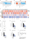 Figure 6. Disabling CK1δ/CK1ε signaling impairs myeloma mitochondrial function via suppression of the TCA cycle and the ETC. A and B, Heat maps depicting log2 ratio for metabolites in the TCA cycle in MM.1S (A) and 8226 (B) myeloma cells treated for 8 or 24 hours with vehicle or 250 nmol/L SR-3029. C, Gene expression of GO: Mitochondrion genes from RNA-seq data for MM.1S and 8226 myeloma cells treated with vehicle or 250 nmol/L SR-3029 for 24 hours. D, Log2-fold change in expression of OGDH in ex vivo multiple myeloma patient samples treated with vehicle versus SR-3029; data are plotted relative to vehicle-treated cells, dashed line. E–H, OCR was measured in MM.1S and 8226 myeloma cells that were pretreated for 24 hours with vehicle, 125 nmol/L SR-3029, or 250 nmol/L SR-3029 and cultured in modified RPMI (Seahorse Biosciences) containing glutamate, malate, and pyruvate before adding succinate to inhibit complex I activity, and ascorbate plus TMPD to activate complex IV. Statistical calculations for complex activity were performed using one-way ANOVA analysis compared with vehicle. ***, P ≤ 0.001; ****, P ≤ 0.0001. The values of detection are represented as the mean and SD (n = 6/group). I, Log2-fold change in expression of complex I components in ex vivo multiple myeloma patient samples treated with vehicle versus SR-3029; data are plotted relative to vehicle-treated cells, dashed line.