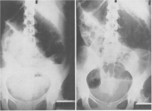 Fig. 1, Fig. 2.