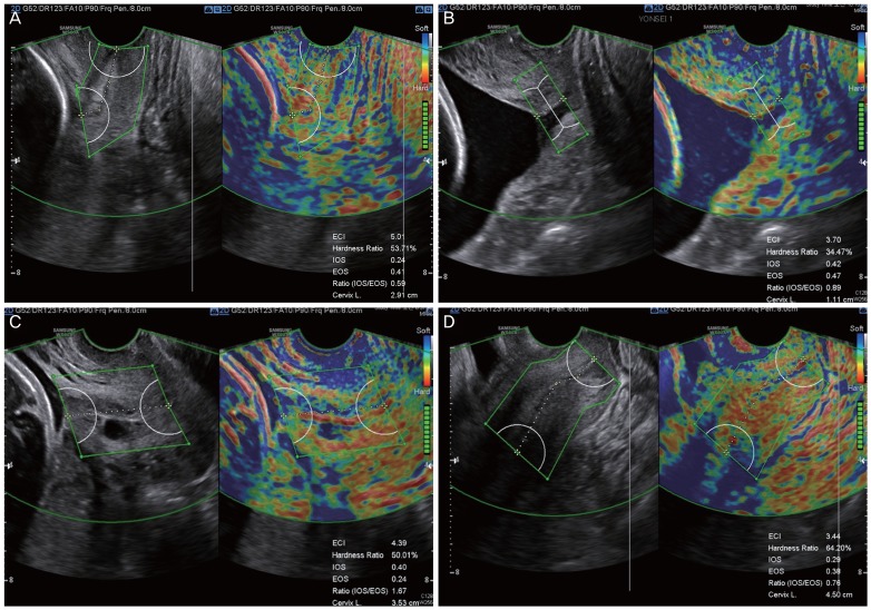 Fig. 4