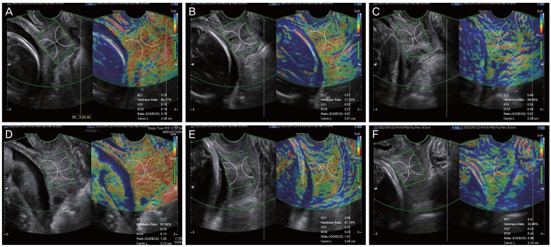 Fig. 2