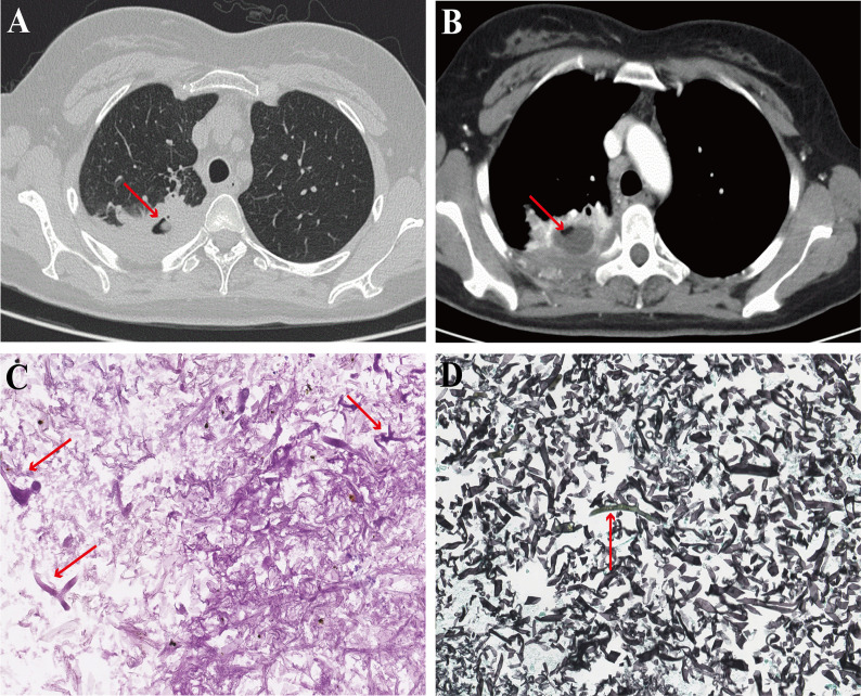 FIG 4