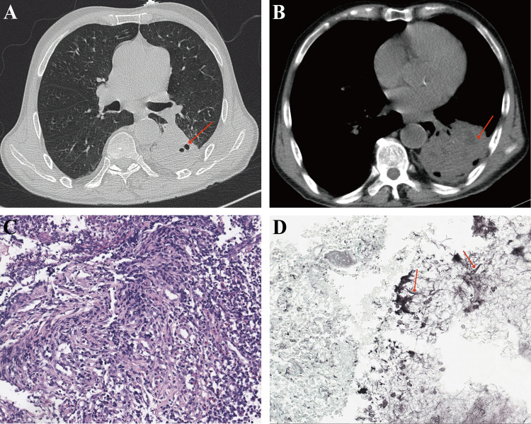 FIG 3