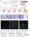 Figure 1. Chemotherapy triggers NET formation. A and B, Adult male C57BL/6J mice were intraperitoneally injected with L-OHP (3 mg/kg) for 5 consecutive days for a total dose of 15 mg/kg to induce mechanical hyperalgesia. The mechanical pain threshold was tested for 14 days by the von Frey test (n = 8). L-OHP = oxaliplatin. C, The protein level of H3Cit in the DRG was evaluated by western blot on the 14th day after the initiation of L-OHP treatment (n = 4). D, Quantification of MPO activity was assessed in the DRG on day 14 after the initiation of L-OHP treatment (n = 8). E–G, The content of H3Cit, NE, and cfDNA in plasma after intraperitoneal injection of L-OHP was evaluated using the H3Cit ELISA kit, NETosis Assay, and Quant-iTPico green dsDNA assay, respectively, at day 14 after the initiation of L-OHP treatment (n = 8). H, Mice were intraperitoneally injected with carboplatin (CBP; 10 mg/kg) three times (days 1, 3, and 7); cisplatin (DDP; 2.3 mg/kg) for 5 consecutive days; paclitaxel (PTX; 8 mg/kg) three times (days 1, 3, and 5); and vincristine (VLB; 100 μg/kg) for 5 consecutive days to induce mechanical hyperalgesia. Then, the level of cf-NDA in plasma was evaluated by Quant-iTPico green dsDNA assay at day 7 after the initiation of chemotherapeutic drugs (n = 6). I, Representative IHC images of hind paw cross-sections stained with the NET marker H3Cit from mice treated with saline or L-OHP. The zones of the dermis and subcutaneous tissue are labeled with dotted lines, and the arteries are labeled with asterisks (n = 3). Scale bar, 50 μm. J, Representative immunofluorescence microscopy images of DRG from mice treated with saline or L-OHP stained for Ly6G, H3Cit, and DNA (n = 3). Scale bar, 50 μm. K, Representative in vivo multiphoton microscopy images of neutrophils (purple), NETs (red), and vessels (green) in the ears of mice 5 days after the initiation of L-OHP treatment. Neutrophils were localized in ear vessels and in the parenchyma. Blood vessels (green) were labeled by intravenous injection of FITC-dextran (MW = 2,000,000 Da). Neutrophils (purple) were labeled by intravenous injection of APC-conjugated monoclonal Ly6G antibody. NETs (red) were labeled by intravenous injection of Sytox Orange (n = 3). Scale bar, 50 μm. L, Mice were administrated 300 μg anti-mouse Ly6G 1 day before the initiation of L-OHP treatment and every 3 days after that until day 14. IgG2α isotype control was administered in the same way. The mechanical pain threshold was tested for 14 days by the von Frey test (n = 6). M, WT and Pad4−/− mice were intraperitoneally injected with L-OHP (3 mg/kg) for 5 days. The mechanical pain threshold was tested for 14 days by the von Frey test. N, PAD4 inhibitor Cl-amidine (10 mg/kg, i.p.) and MPO inhibitor PF-1355 (50 mg/kg, i.p.) were administered 1 day before the initiation of L-OHP administration once a day until the end of 14 days. The mechanical pain threshold was tested for 14 days by the von Frey test (n = 8). O, The concentration of H3Cit in the plasma of mice mentioned in M and N was evaluated by ELISA on day 14 (n = 6). ***, P < 0.001. Data, mean ± SEM.
