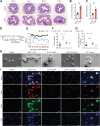 Figure 2. Chemotherapy induces gut microbe–derived NET formation. Adult male C57BL/6J mice were intraperitoneally injected with L-OHP (3 mg/kg) for 5 days for a total dose of 15 mg/kg. A, The degree of intestinal barrier disruption and inflammatory infiltration were evaluated by H&E staining (n = 3). Scale bar, 50 μm. B and C, LPS levels in the serum and DRG of mice were evaluated by Pierce Chromogenic Endotoxin Quant Kit (n = 8). D and E, For gut microbiota eradication, mice were provided drinking water containing 0.5 g/L ampicillin, 0.5 g/L neomycin, 0.5 g/L metronidazole, and 0.25 g/L vancomycin with 3 g/L artificial sweetener Splenda for 3 weeks. Then, the mice were intraperitoneally injected with L-OHP (3 mg/kg) for 5 days. The mechanical pain threshold was tested for 14 days by the von Frey test (n = 8). F and G, The level of H3Cit and NE in plasma was evaluated at day 14 after the initiation of L-OHP treatment using the H3Cit ELISA kit and NETosis Assay, respectively (n = 8). H, NET formation was examined by scanning electron microscopy following 4 hours of stimulation of neutrophils with LPS (10 ng/mL), L-OHP (10 μmol/L), or LPS (10 ng/mL) + L-OHP (10 μmol/L). Cells treated with LPS (1 μg/mL) were used as a positive control (n = 3). Scale bar, 10 μm. I, Neutrophils derived from mouse bone marrow were pretreated with LPS (10 ng/mL), L-OHP (10 μmol/L), or LPS (10 ng/mL) + L-OHP (10 μmol/L) for 4 hours, and immunofluorescence staining of NETs was performed: H3Cit (green), MPO (red), and DAPI (blue). The white arrow showed the details of NETs (n = 3). Scale bar, 50 μm. ***, P < 0.001. Data are shown as mean ± SEM.