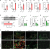 Figure 3. Oxaliplatin induces NET-mediated proinflammatory cytokine production. A–F, Adult male C57BL/6J mice were intraperitoneally injected with L-OHP (3 mg/kg) for 5 days for a total dose of 15 mg/kg. The levels of IL1β, IL6, and TNFα in plasma and DRG were evaluated by ELISA on day 14 after the initiation of L-OHP treatment (n = 8). G, The level of phospho-NF-κB p65 protein in the DRG was evaluated by western blot on the 14th day after the initiation of L-OHP treatment (n = 4). H, Representative immunofluorescence microscopy images of DRGs from WT and Pad4−/− mice stained with F4/80 (green) and H3Cit (red) on the 14th day after the initiation of L-OHP treatment. The white boxed area shows the details of NETs colocalizing with macrophages (white arrow; n = 3). Scale bar, 50 μm. I–K, The levels of Il1b, Il6, and Tnfa mRNA in the DRG were evaluated by qPCR at day 14 after the initiation of L-OHP treatment in WT and Pad4−/− mice (n = 4). ***, P < 0.001. Data are shown as mean ± SEM.