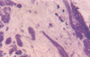 Figure 35