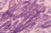 Figure 33