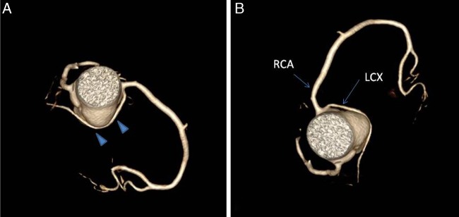 Figure 3