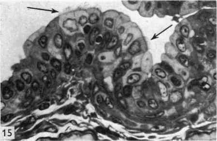 Fig. 15