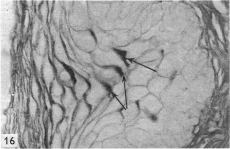 Fig. 16