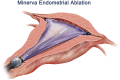 Fig. 9
