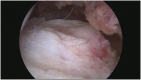 Fig. 15