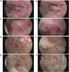 Fig. 16