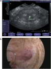 Fig. 13