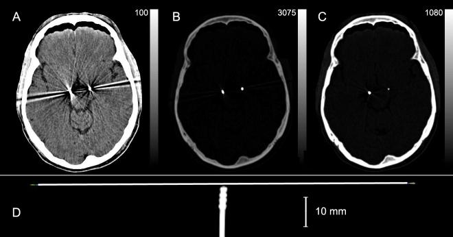 Fig 2