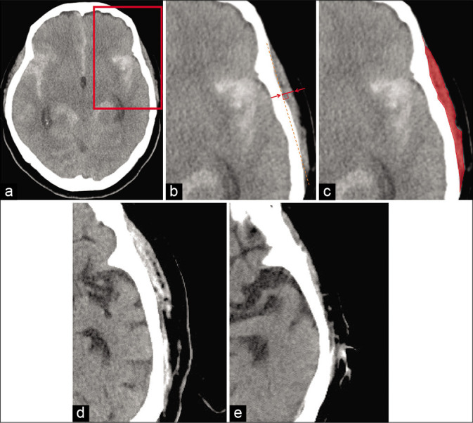 Figure 1: