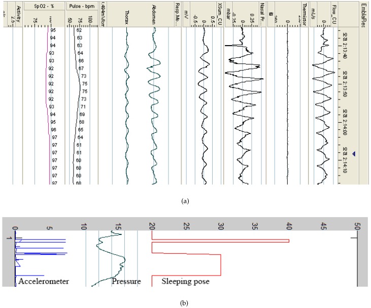 Figure 12