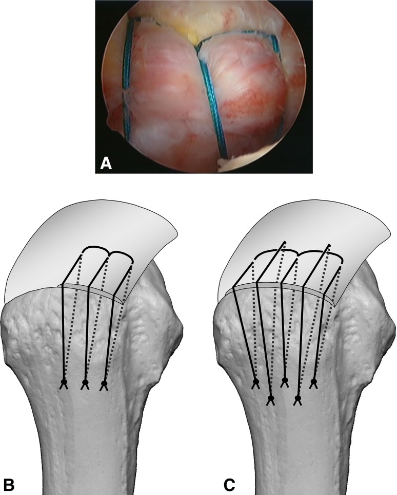 Fig. 10A–C