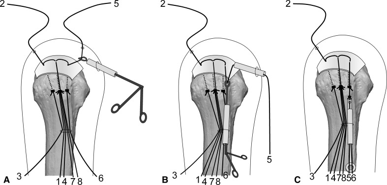 Fig. 9A–C