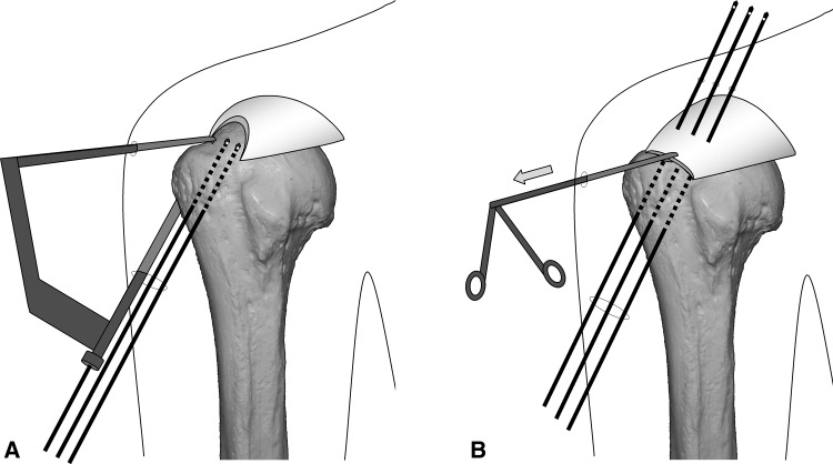 Fig. 1A–B