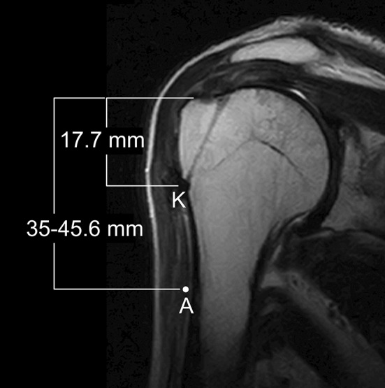 Fig. 12