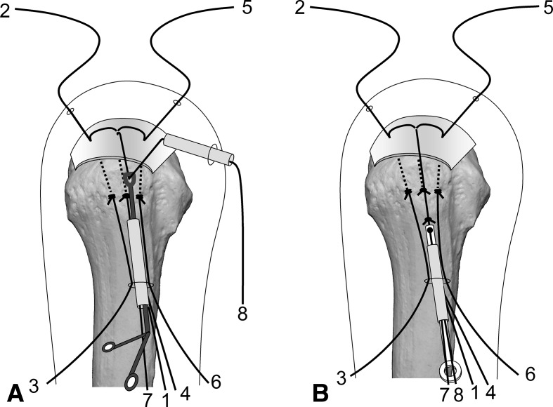 Fig. 8A–B