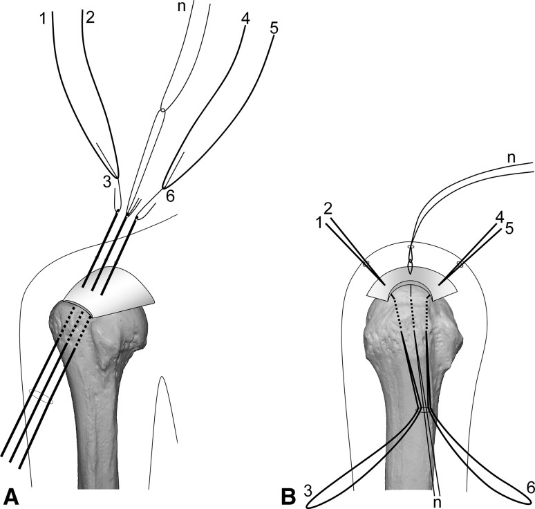 Fig. 2A–B