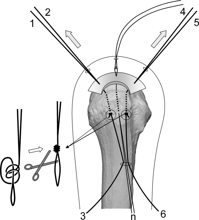 Fig. 3