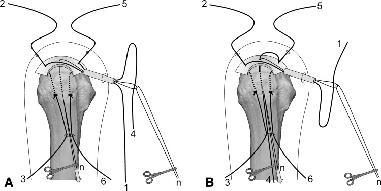 Fig. 5A–B