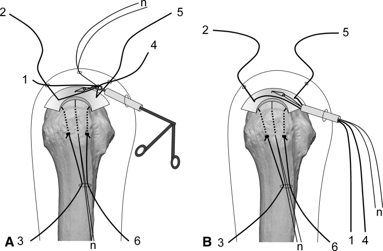 Fig. 4A–B