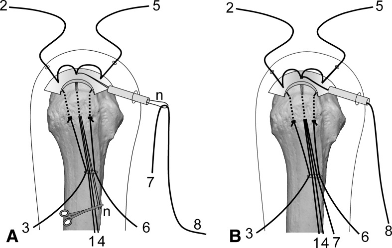 Fig. 6A–B